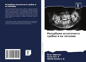 Imagen del vendedor de Rezorbciq ostatochnogo grebnq i ee lechenie a la venta por buchversandmimpf2000