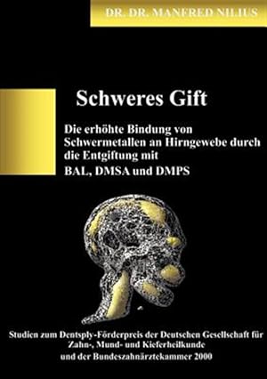 Immagine del venditore per Schweres Gift -Language: German venduto da GreatBookPrices