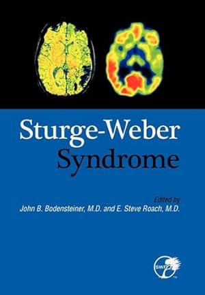 Imagen del vendedor de Sturge-Weber Syndrome a la venta por Rarewaves.com USA