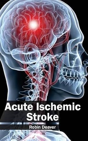Seller image for Acute Ischemic Stroke for sale by Rarewaves USA