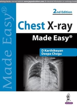 Seller image for Chest X-ray Made Easy for sale by Rarewaves.com USA
