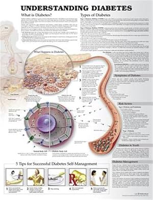 Immagine del venditore per Understanding Diabetes Anatomical Chart venduto da GreatBookPrices