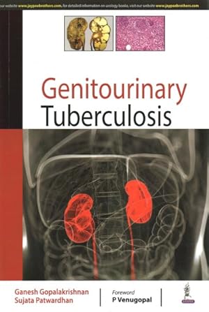 Seller image for Genitourinary Tuberculosis for sale by GreatBookPrices