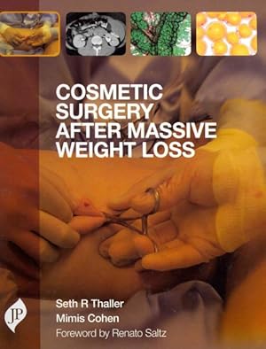 Immagine del venditore per Cosmetic Surgery After Massive Weight Loss venduto da GreatBookPrices
