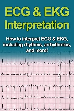 Immagine del venditore per ECG & EKG Interpretation | How to interpret ECG & EKG, including rhythms, arrhythmias, and more! venduto da preigu