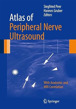 Bild des Verk�ufers f�r Atlas of Peripheral Nerve Ultrasound | With Anatomic and MRI Correlation zum Verkauf von preigu