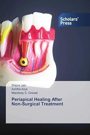Bild des Verk�ufers f�r Periapical Healing After Non-Surgical Treatment zum Verkauf von preigu