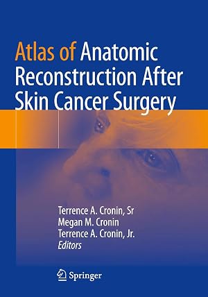 Imagen del vendedor de Atlas of Anatomic Reconstruction After Skin Cancer Surgery a la venta por preigu