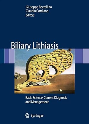 Imagen del vendedor de Biliary Lithiasis | Basic Science, Current Diagnosis and Management a la venta por preigu