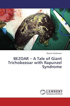 Bild des Verk�ufers f�r BEZOAR - A Tale of Giant Trichobezoar with Rapunzel Syndrome zum Verkauf von preigu