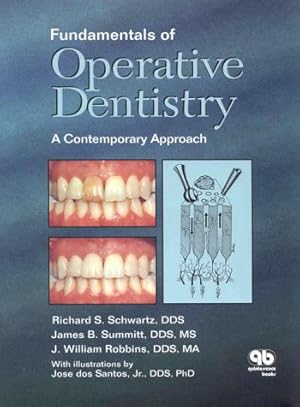 Immagine del venditore per Fundamentals of Operative Dentistry: A Contemporary Approach venduto da -OnTimeBooks-
