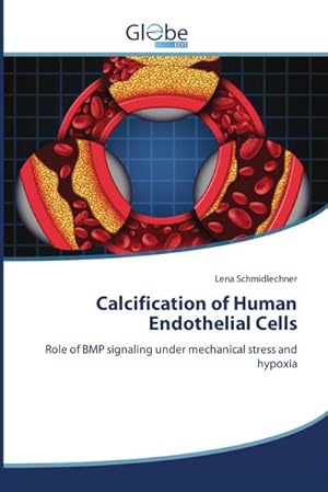 Immagine del venditore per Calcification of Human Endothelial Cells venduto da buchversandmimpf2000