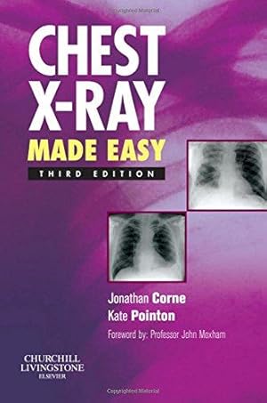 Bild des Verk�ufers f�r Chest X-Ray Made Easy zum Verkauf von WeBuyBooks