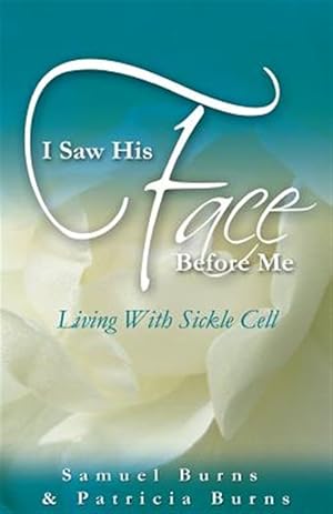 Bild des Verk�ufers f�r I Saw His Face Before Me - Living with Sickle Cell Anemia zum Verkauf von GreatBookPrices