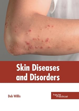 Imagen del vendedor de Skin Diseases and Disorders a la venta por GreatBookPrices