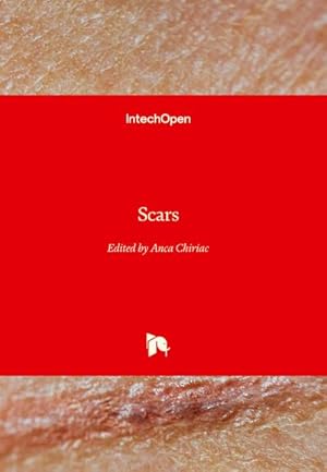 Imagen del vendedor de Scars a la venta por AHA-BUCH GmbH