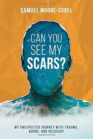 Seller image for Can You See My Scars?: My Unexpected Journey With Trauma, Burns, and Recovery for sale by Goodwill of Central and Coastal Virginia