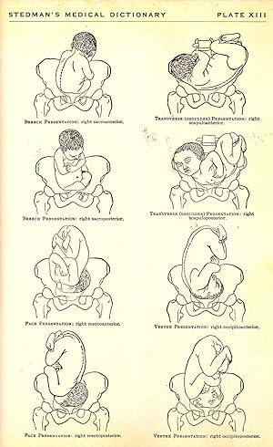 Immagine del venditore per Stedman's Practical Medical Dictionary of words used in medicine with their derivation & pronunciation including dental, veterinary, chemical botanical, electrical, life insurance, & other special terms.; Oath of Hippocrates; Table of Drugs, etc] venduto da Joseph Valles - Books