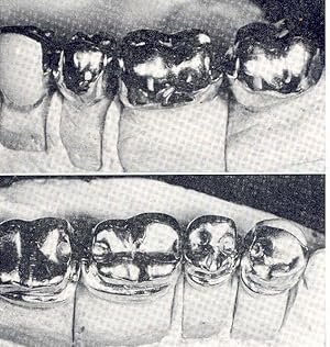 Imagen del vendedor de Partial denture construction, principles and techniques. [The clasp partial denture; Occlusal rests; Direct retainers; Preparation of abutment teeth; Miscellaneous partial prosthodontics; Relining and rebasing the partial denture; etc] a la venta por Joseph Valles - Books