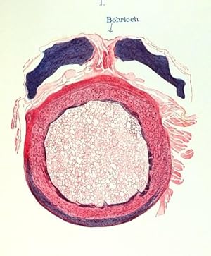 Ueber Elfenbein in der Osteoplastik und über Elfenbein- und Hornheilung (pp.586-619, 24 Abb., 3 T...