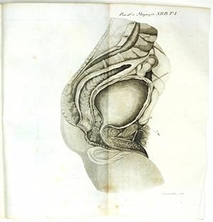 Ueber die Methode, Blasensteine durch das Rectum auszuziehen. Mitgetheilt von Dr. Jung und Dr. We...