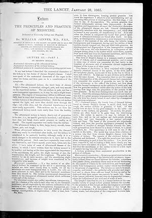 Seller image for The Lancet. 28 January 1865. PRINCIPLE & PRACTICE of MEDICINE - BRIGHT'S DISEASE (III pt1)., SCRIVENERS' PALSY,. CONSTITUTIONAL CHARACTER & MODIFICATIONS of SKIN DISEASES., ABSCESS of THE BRAIN for sale by Tony Hutchinson