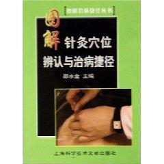 Seller image for graphical identification and treatment of acupuncture points Shortcuts (Paperback)(Chinese Edition) for sale by liu xing