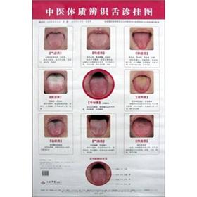 Imagen del vendedor de TCM constitution wall charts recognize Tongue (Paperback)(Chinese Edition) a la venta por liu xing