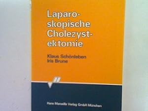 Seller image for Laparoskopische Cholezystektomie for sale by books4less (Versandantiquariat Petra Gros GmbH & Co. KG)