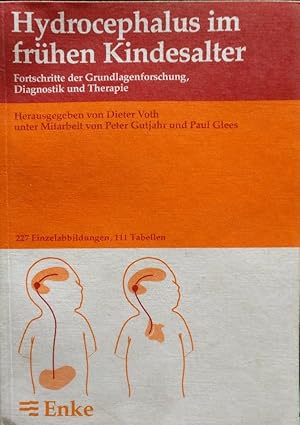 Hydrocephalus im frühen Kindesalter - Fortschritte der Grundlagenforschung, Diagnostik und