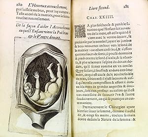 De la grossesse et accouchement des femmes. Du gouvernement d'icelles et moyen de survenir aux ac...