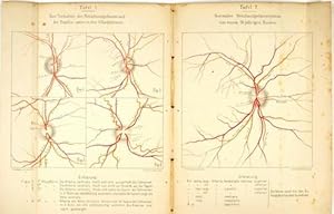 Bild des Verkufers fr Die makroskopischen Gefsse der Menschlichen Netzhaut. Versuch einer Schematisierung und Nomenclatur des Netzhautgefssystems. zum Verkauf von Antiq. F.-D. Shn - Medicusbooks.Com