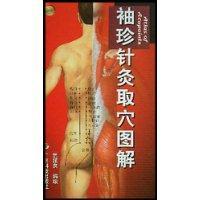 Imagen del vendedor de Pocket acupuncture acupoints graphic(Chinese Edition) a la venta por liu xing