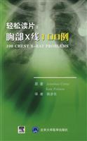 Seller image for easy to read piece: chest X ray of 100 cases(Chinese Edition) for sale by liu xing