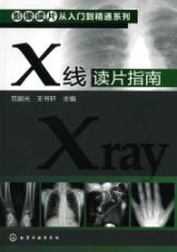 Seller image for X ray film reading guide(Chinese Edition) for sale by liu xing