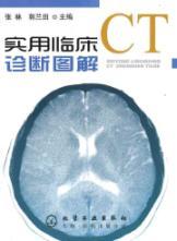 Imagen del vendedor de CT diagnosis of clinical and practical graphic(Chinese Edition) a la venta por liu xing