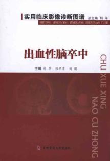 Bild des Verkufers fr Practical Clinical Diagnostic Imaging Atlas: Hemorrhagic Stroke(Chinese Edition) zum Verkauf von liu xing