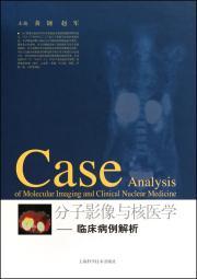 Immagine del venditore per Molecular Imaging and Nuclear Medicine: Clinical Case Analysis(Chinese Edition) venduto da liu xing