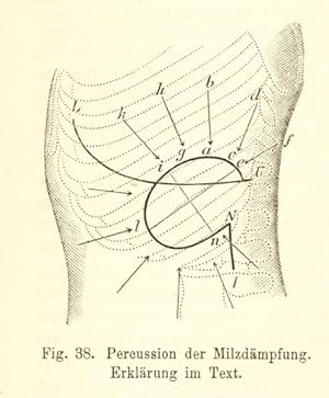 Lehrbuch der inneren Krankheiten für Studierende und Ärzte. I.Abtheilung.