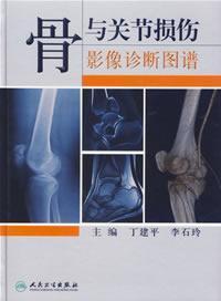 Immagine del venditore per diagnostic imaging of bone and joint injuries map(Chinese Edition) venduto da liu xing