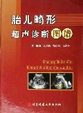 Seller image for Sonographic practice lllustrated of fetal abnormalities(Chinese Edition) for sale by liu xing