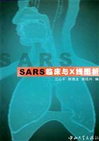 Seller image for SARS clinical X-ray map analysis(Chinese Edition) for sale by liu xing