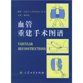 Seller image for Vascular reconstructions(Chinese Edition) for sale by liu xing