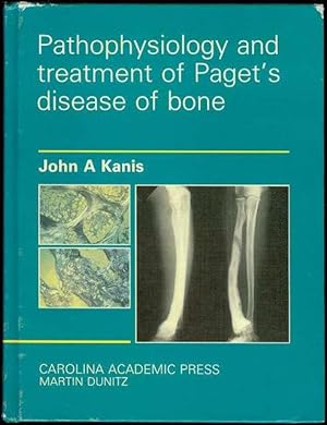 Bild des Verkufers fr Pathophysiology and Treatment of Paget's Disease of Bone zum Verkauf von Bookmarc's