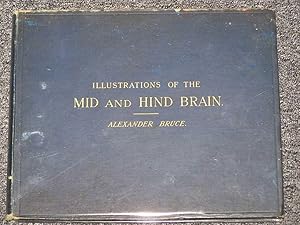 Illustrations of the Mid and Hind Brain