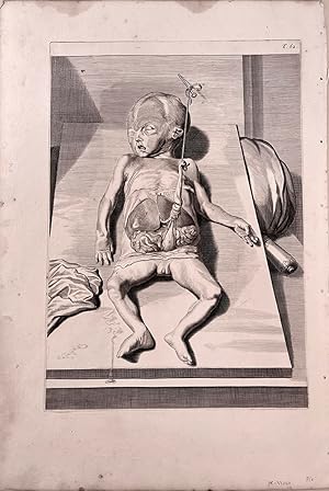 Bild des Verkufers fr Plate 62 (dissected fetus) from Anatomia humani corporis. 40 x 27.5cm (image size) in a trim of 51 x 35.5 cm zum Verkauf von Jeremy Norman's historyofscience