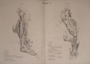 Ein Beitrag zur pathologischen Anatomie der Geschwülste im Verlaufe der Nerven.