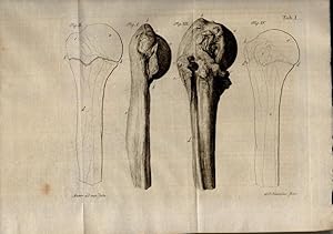 Medizinische Dissertation. De epiphysium ab ossium diaphysi diductione. (Über die Trennung der Ep...