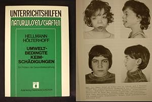 Immagine del venditore per Umweltbedingte Keimschdigungen - Ein Problem der Gesundheitserziehung venduto da Buchantiquariat Uwe Sticht, Einzelunter.