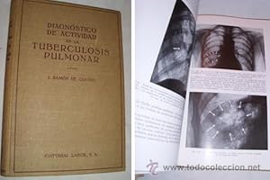 Seller image for DIAGNSTICO DE ACTIVIDAD EN LA TUBERCULOSIS PULMONAR for sale by Librera Maestro Gozalbo